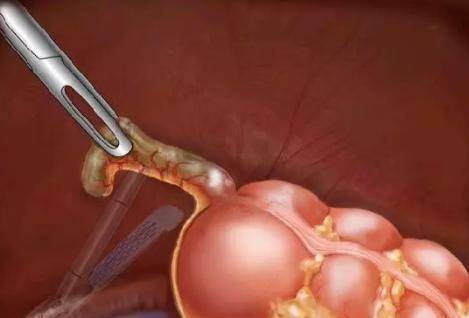 生活|人体的八个器官或可以“拿掉”，且不会影响正常生活，是真的吗？