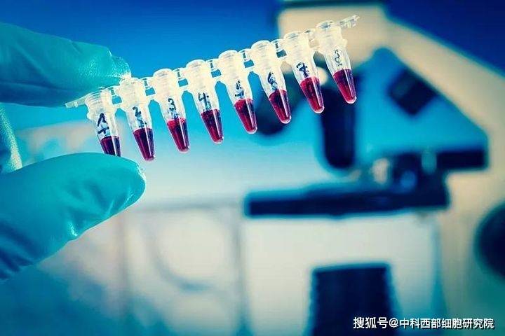 治疗|中科西部干细胞研究院：不同移植途径干细胞疗法治疗肝硬化研究案例