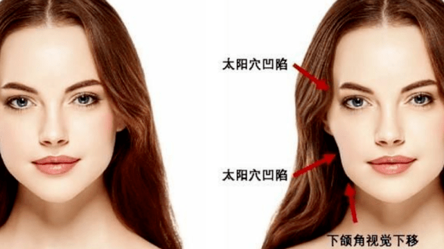 什么揭秘,再生美水剥离是什么!OMG!剥离微整的利弊你可知道?