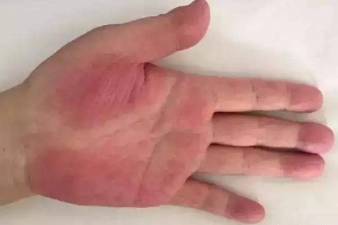 肝脏|吃一口等于5斤猪肝,肝脏科主任:敞开吃,肝脏越来越柔软