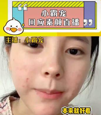 化妆品小霸宠首次透露素颜直播原因，审美跟大家不同，觉得满脸痘很好看