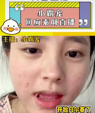 化妆品小霸宠首次透露素颜直播原因，审美跟大家不同，觉得满脸痘很好看