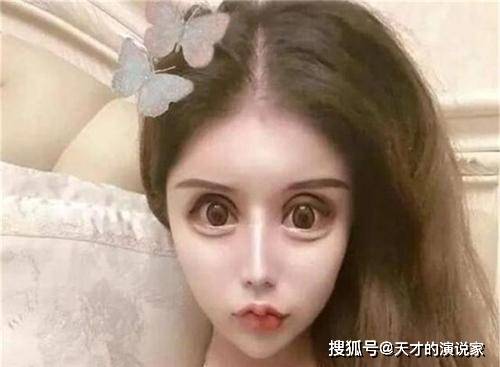 事情还记得花百万整容的网红女孩吗？3年整了百次，如今前后判若两人