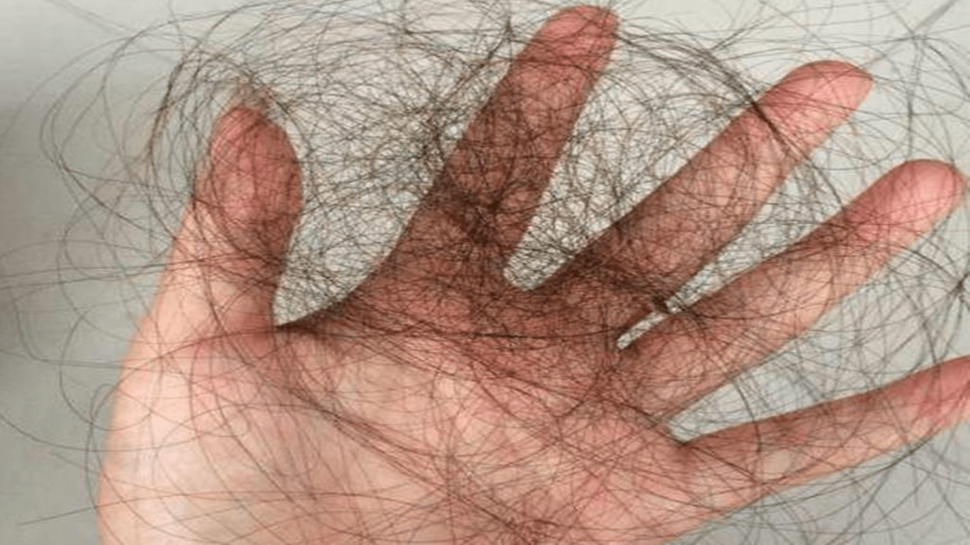 头发|每天掉超过100根头发是脱发？脱发5大元凶，少碰为妙