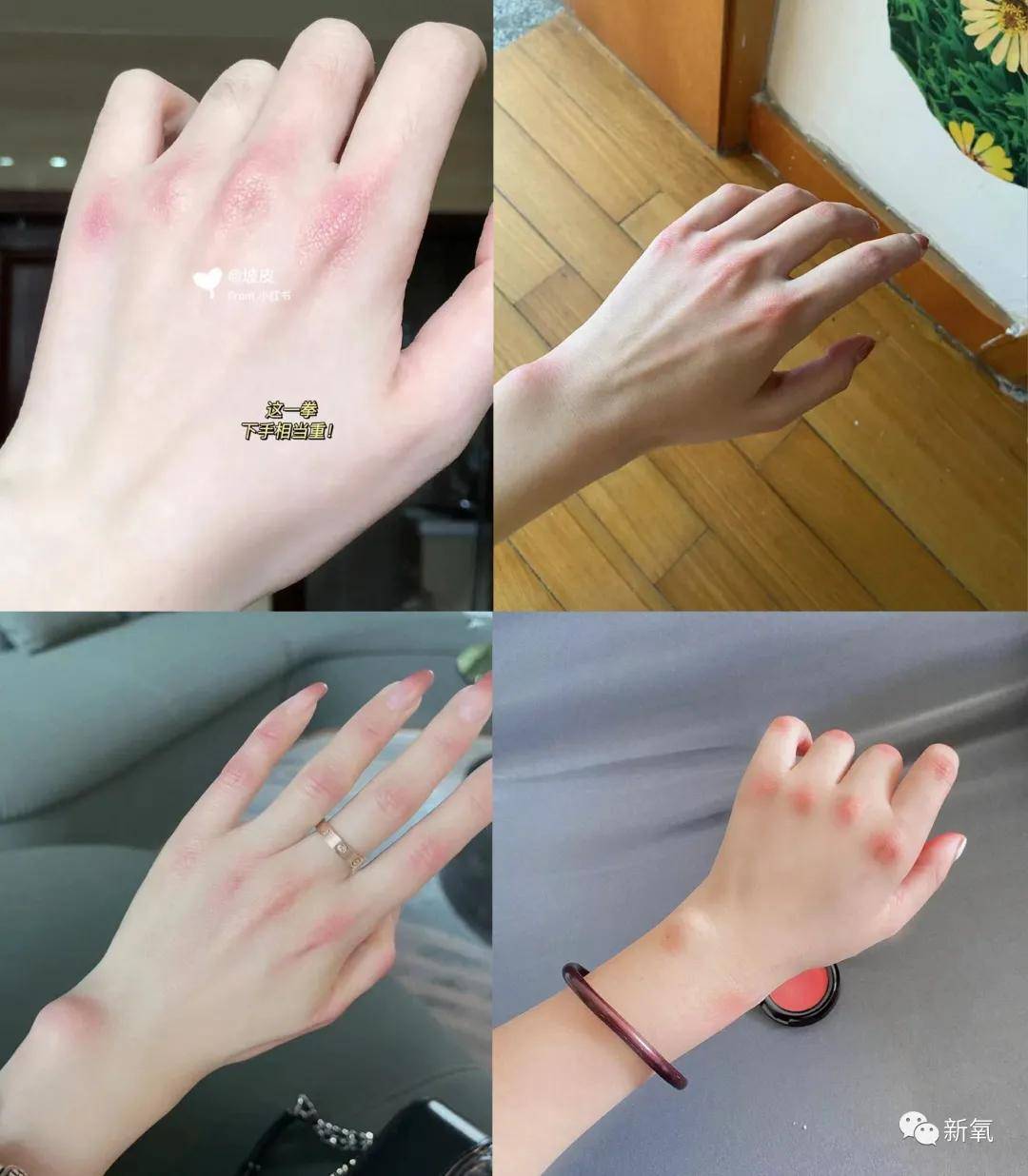 八卦爆料贵圈所谓的纯欲天花板，就是在关节上打腮红吗？