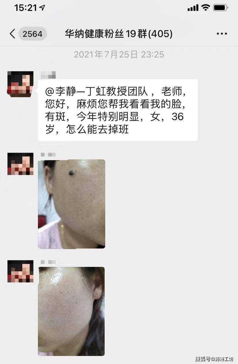 小安箹诗工坊:脸上有很明显的斑，应该如何护理？