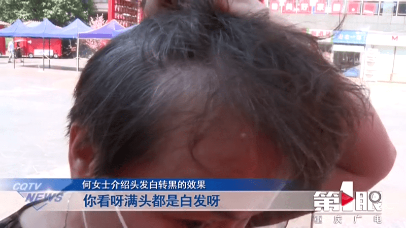网友|女子花4万做“白发转黑”，结果治疗就是拔了白发