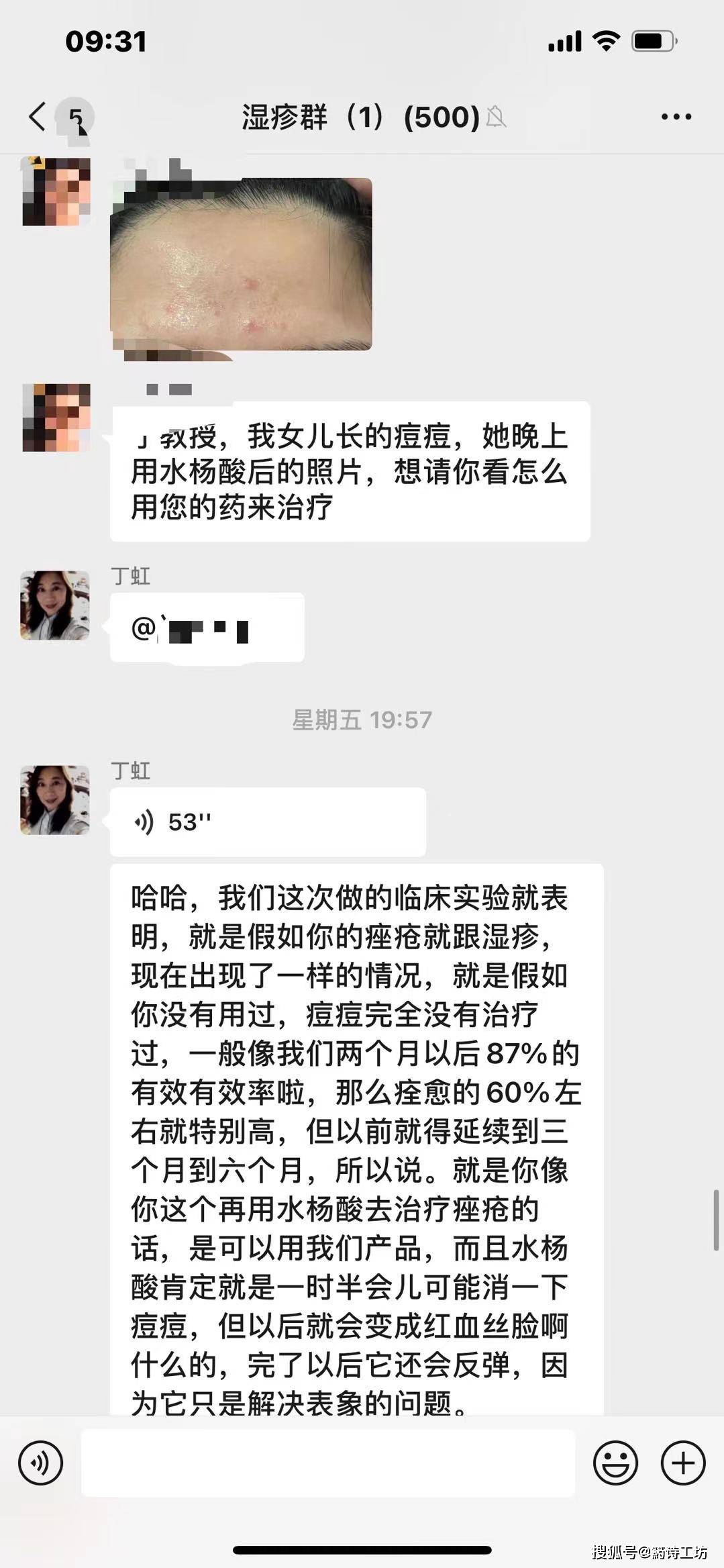 治疗药诗工坊:女儿额头上痘痘，用过水杨酸后，再应该怎么样护理？