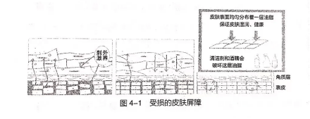 果酸敏感性皮肤怎么办？别怕！避免这几种成分就够了！（上）