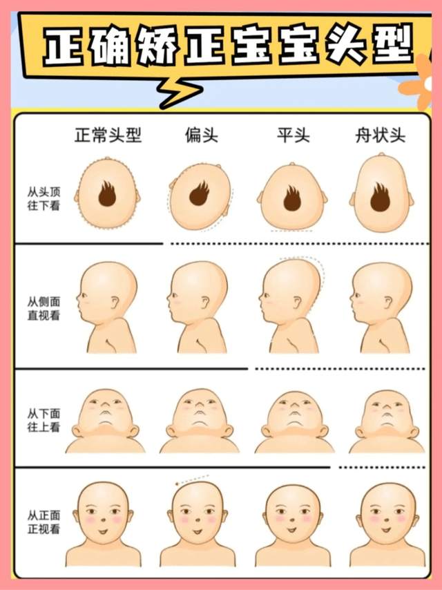 如何矫正宝宝的头型?这五种方法教你如何矫正