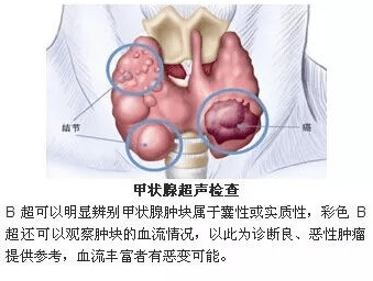 61a5650fd04e4a6a910137572110ed34.png