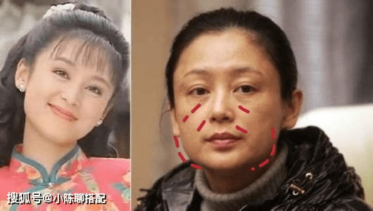 面部女明星都会中招！这几个面部特征最显老，普通人又如何正确避坑？