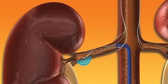 症状|肾功能下降有5个信号，早点发现，也不至于拖成肾衰竭