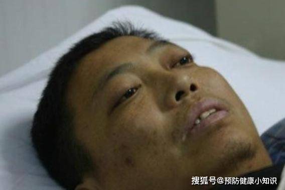 肝脏|肝癌早期不痛不痒，若出现“2黄1红”，别拖了，早检查肝CT