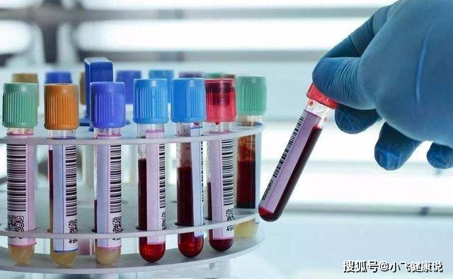 喝什么降转氨酶 4b787aa05fac45c796c4e9a0bb05cb77.jpeg