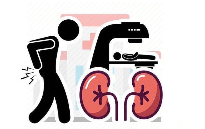 肾脏|为何偏偏尿毒症找上你？医生劝解：3个习惯若能避开，肾怎能坏