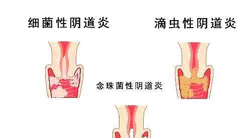 子宫|妇科病的“死对头”发现了，女性拿来当零食吃，子宫或越来越健康