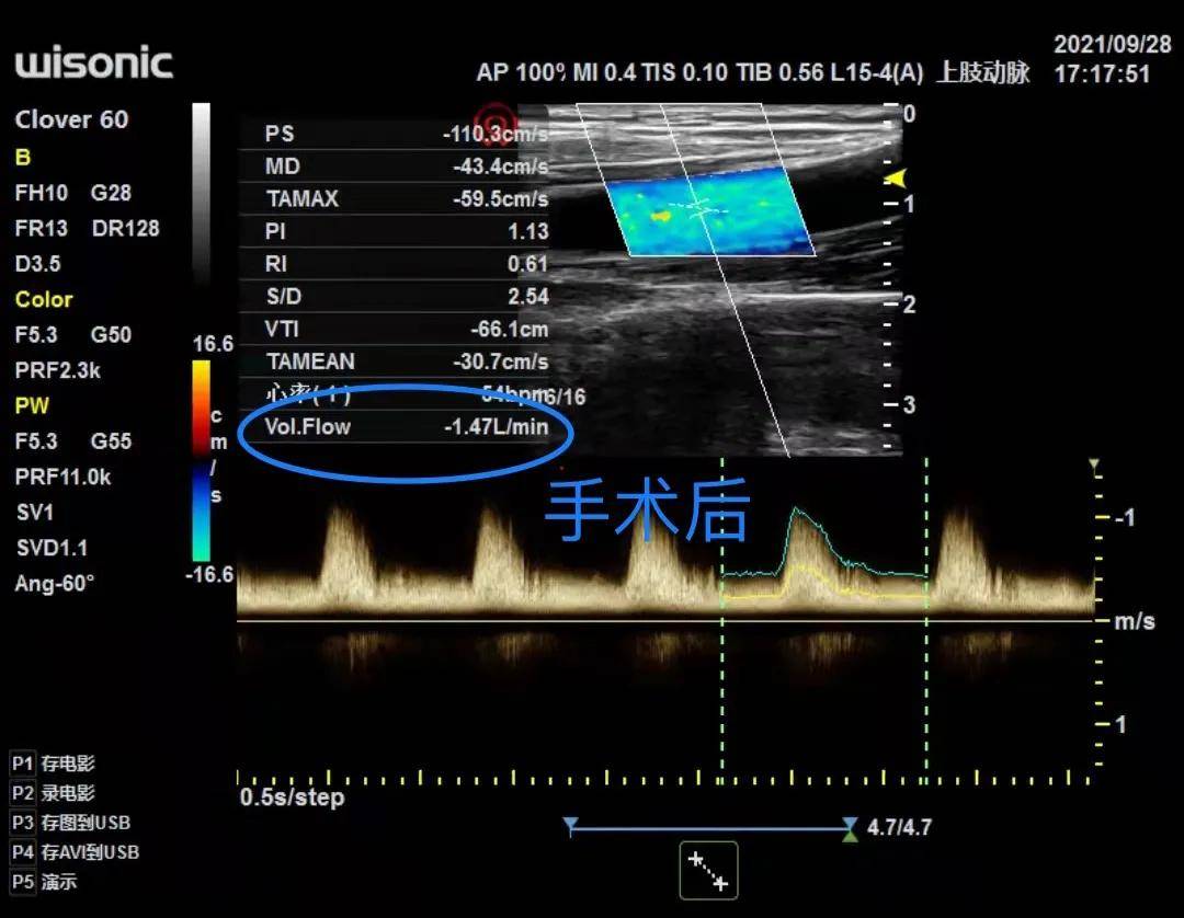 史井波|守瘘人｜“百密终无一疏”