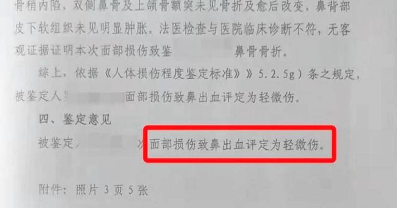 家长|3岁男孩鼻子被幼师打成轻微伤，曾危险驾驶被拘役，家长已起诉