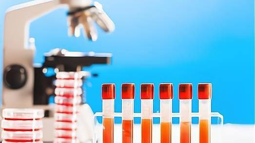 肾脏|你清楚“肾脏疾病”吗？血肌酐，是否检测肾脏健康程度的指标