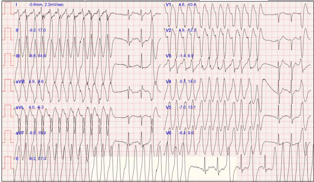 检查|装病？32岁女子一干活就晕倒！婆家人也不理解