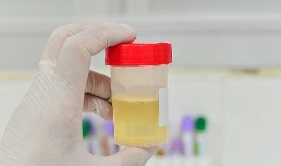 消化道|揭秘:尿毒症早期的五个症状