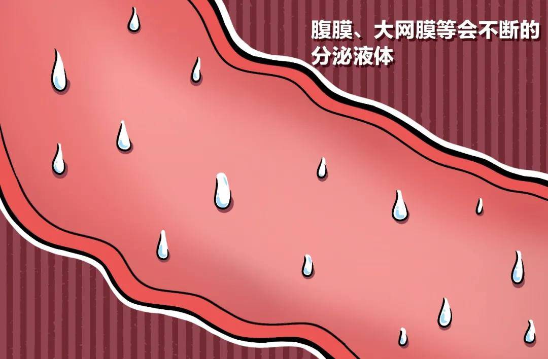 腹膜|这种妇科病不用去医院治！白花钱还还受罪