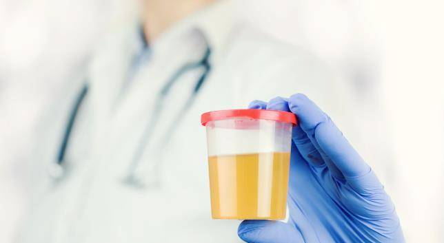 肿瘤|尿液是身体的一面镜子，老年男性注意尿液变化，不能忽略3种问题