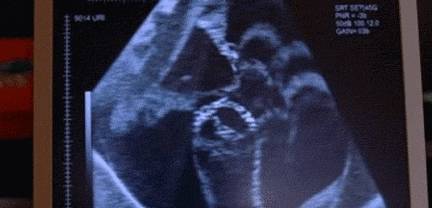 梦境的警示,梦见母亲怀孕并尝试堕胎的深层含义 梦境的警示,梦见母亲怀孕并尝试堕胎的深层含义