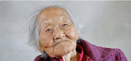 肝脏|100岁老人，肝脏年龄60岁，肝脏年轻化不是运动，常做1件事