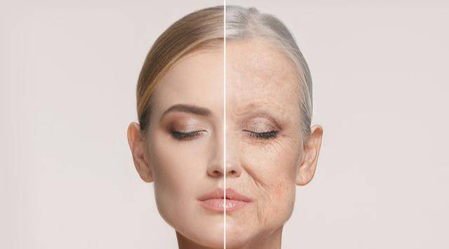 拉皮手术案例 842a47c808484169bf68a2b5dd549bd8.jpeg