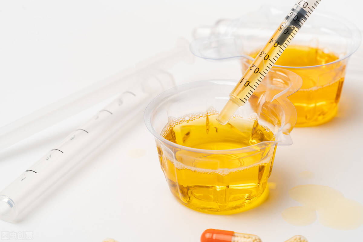 蛋白尿|肾友每年都查肾功能,为何还要验“尿常规”?