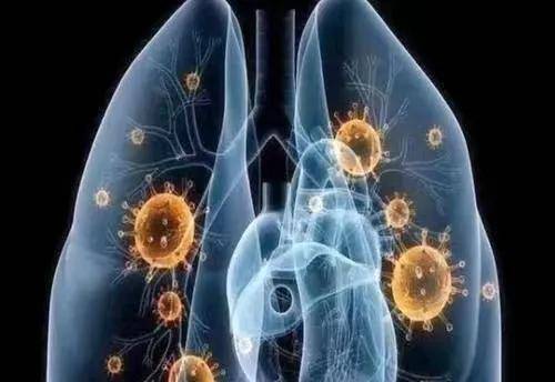 陈根|陈根：新冠病毒，易致肺部纤维化