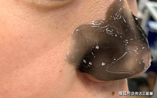 黑头|肝不适,身体知!身体若出现“2疼、3黑”,或该养肝了