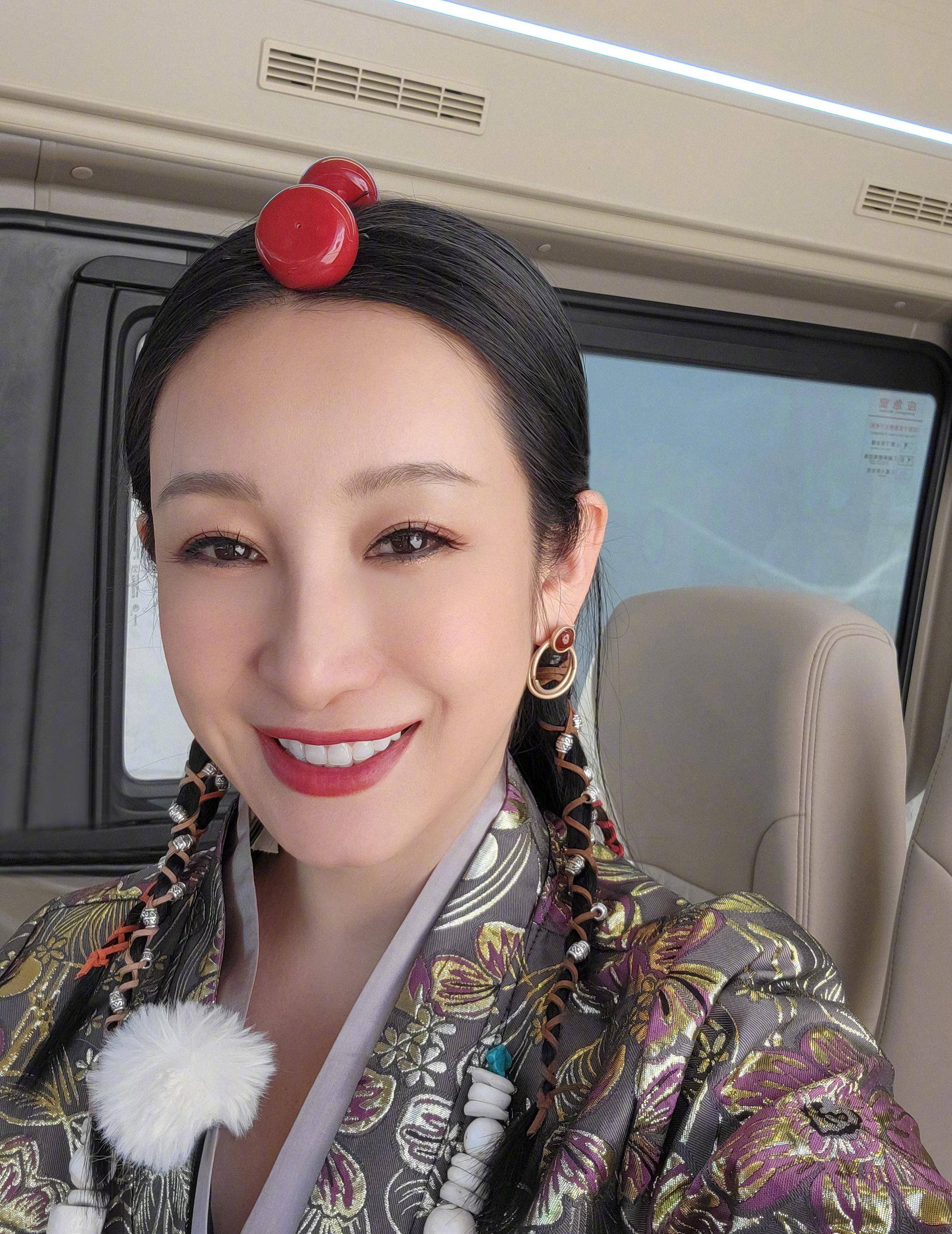 没想到浪漫的背后都是额头换来的,秦海璐录节目晒到额头都脱皮了_全脸