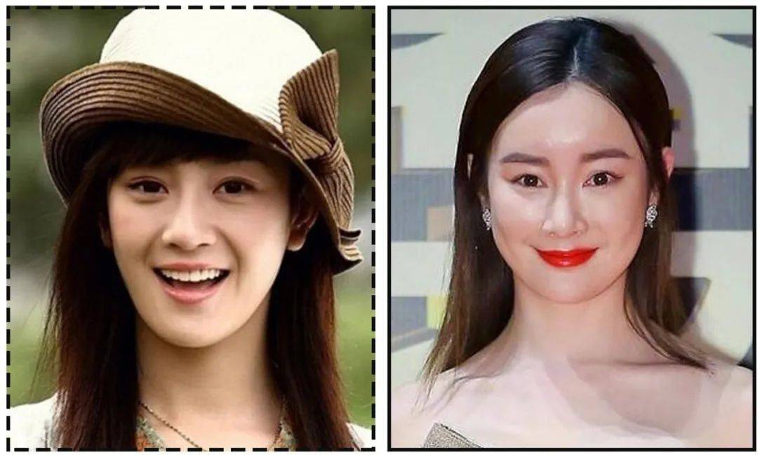 娄艺潇动脸的7位女星，一个比一个神奇，有人请医美专家鉴定自己纯天然