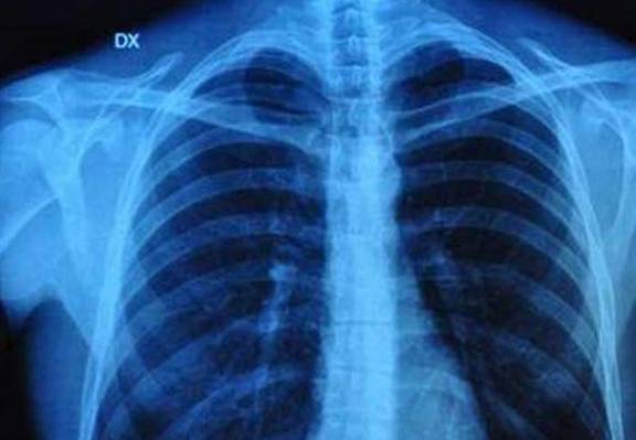 控制|糖友吃二甲双胍讲究多,了解这8个疑问,吃药不伤身