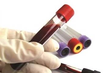 血管|血糖高没用药,坚持六个字,几年来血糖都正常,是逆转康复了吗?