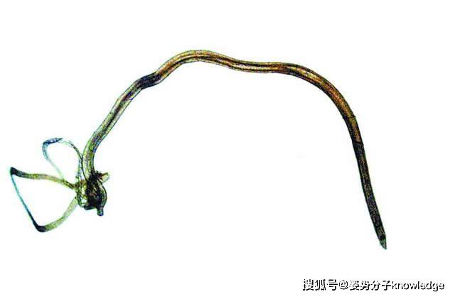 生肉|17岁女孩肠道内发现大量的虫子，寄生虫从何而来？该如何预防