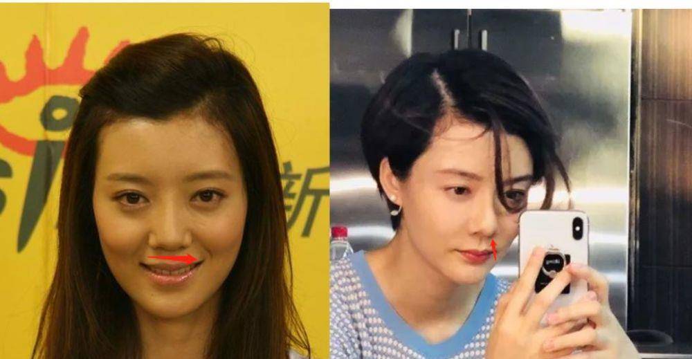 整形这是我见过最敢的女星，猪鼻子还能演美女？