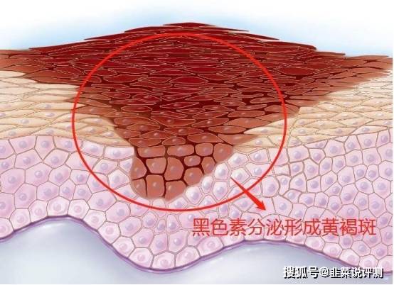 方法一万字美白的方法攻略（超详细，记得点赞收藏），如何全身美白皮肤最快吃什么