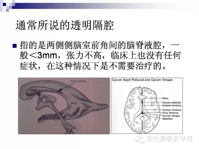 什么时候报透明隔间腔增宽?_平台