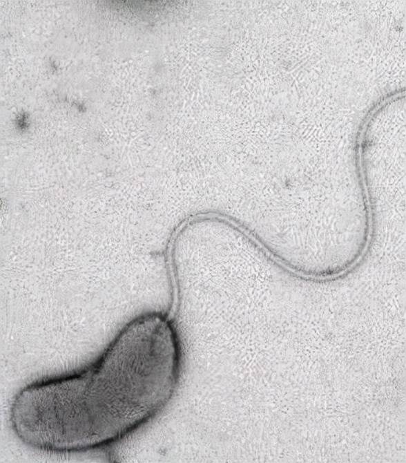 哈维弧菌与发光细菌疾病有关,鳗弧菌是攻击幼虾并导致大量死亡的主要