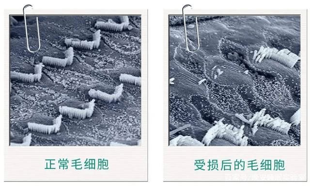 戴耳机还能把耳朵给戴聋?我们该如何科学使用耳机,教你几个用耳小妙招