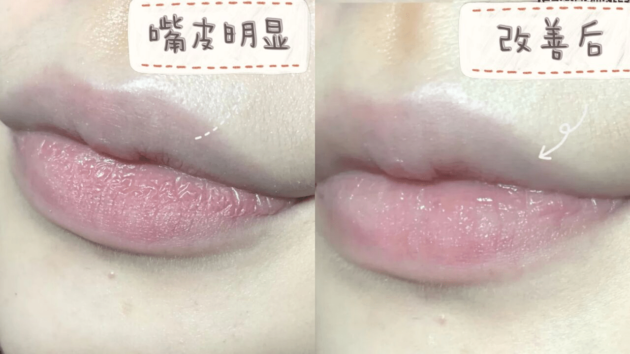 唇膏孕妇唇膏全盘点！用错小心得唇炎，小蓝罐凡士林上孕妇黑榜！慎买