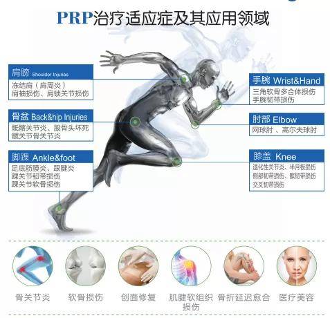 血漿|湘潭市一醫院引進富血小板血漿（PRP）技術