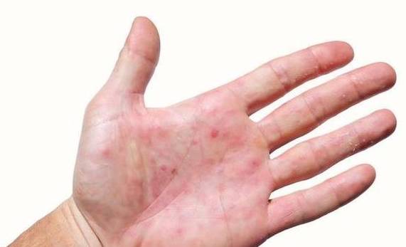 代谢|肝脏变硬时，4个表现可能较明显，若你一个没占，肝脏还算健康