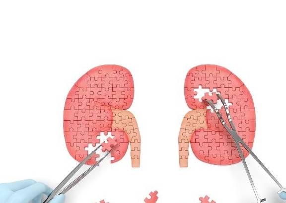 肾脏|这5个“症状”出现时，或许是在“提醒”你，肌酐有些“升高了”