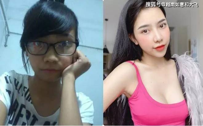 Van越南女子瞒家人整容，变化太大回家“父母认不出”