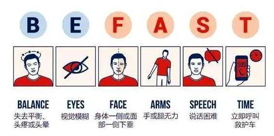 血管|我中风了吗？